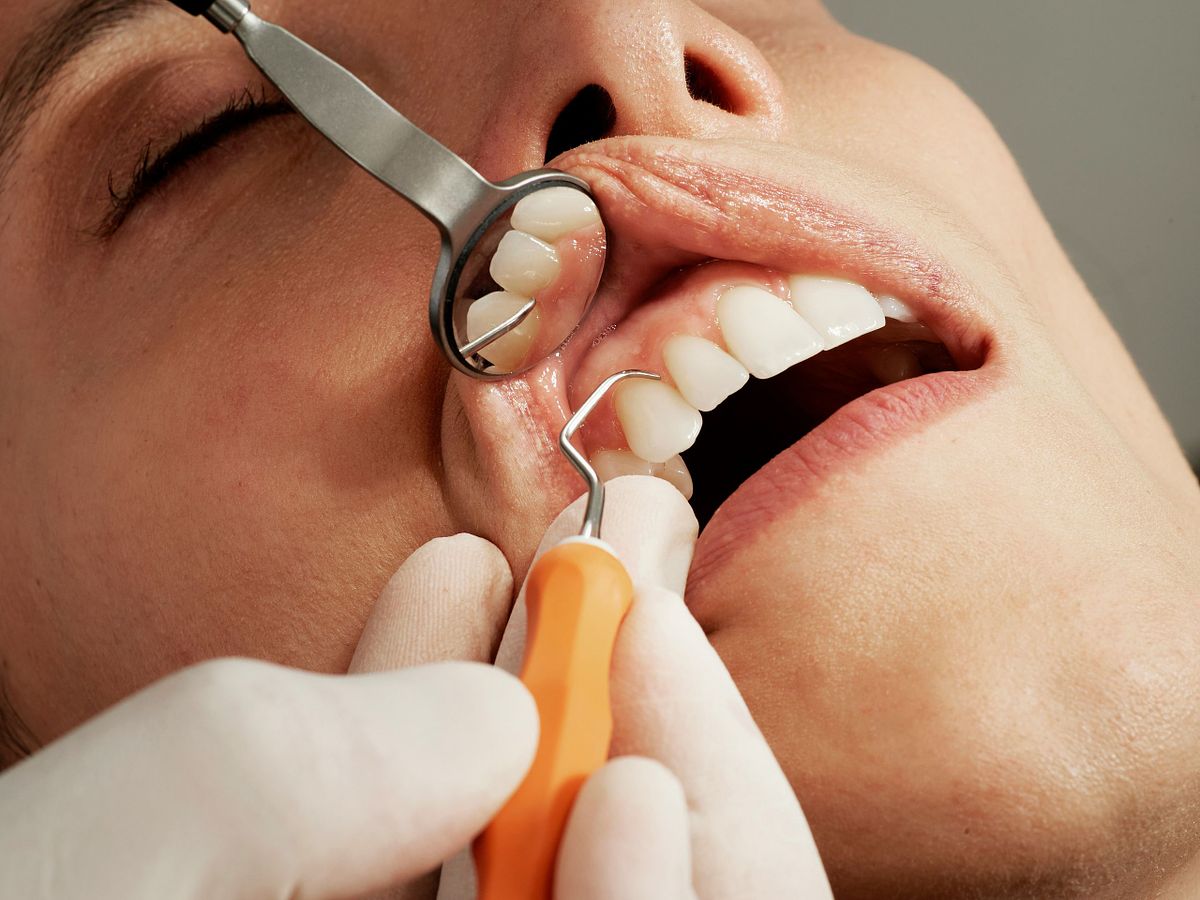 A dentist examines a patient's teeth using a dental mirror and a dental probe showcasing the effect of Philips Sonicare sanitizer usage on oral health