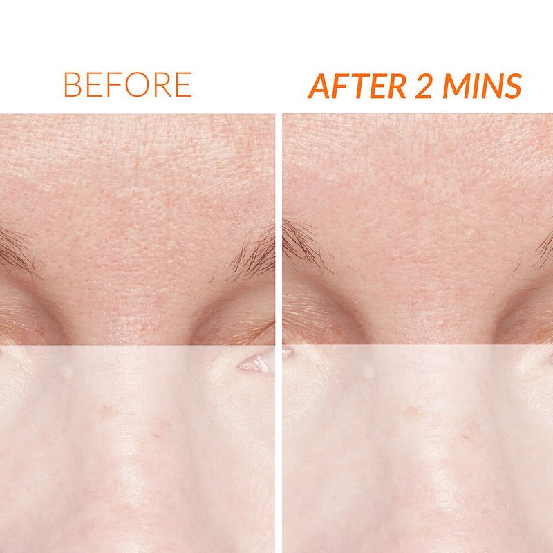 Kate Somerville Intensive ExfoliatingTreatment | علاج المكثف للتقشير